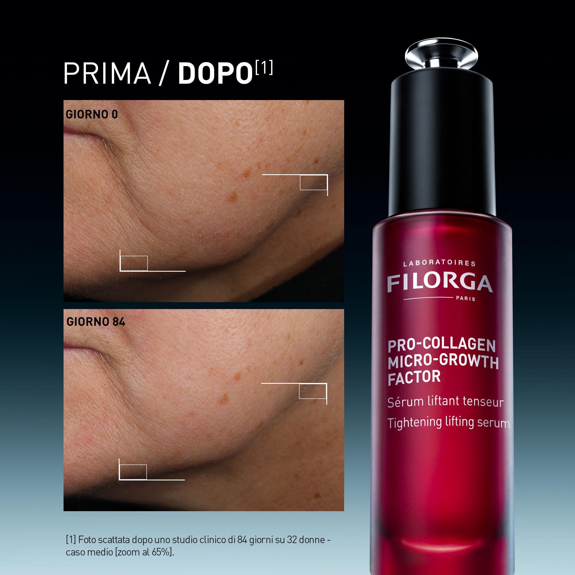 Siero Viso Tensore Ultra-Liftante – prodotto e prima/dopo